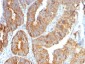 Anti-VEGI (Vascular Endothelial Growth Inhibitor) Antibody