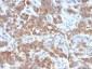 Anti-VEGI (Vascular Endothelial Growth Inhibitor) Antibody