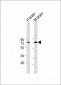 LIMK1 Antibody (C-term)
