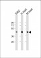 PDK4 Antibody