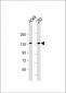 VEGFR3 Antibody