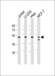 PSMC2 Antibody