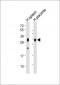 FOLR2 Antibody