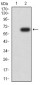 Mouse Monoclonal Antibody to DNMT1