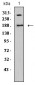 Mouse Monoclonal Antibody to DNMT1