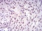 Mouse Monoclonal Antibody to DNMT1