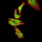 Mouse Monoclonal Antibody to RAN