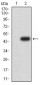 Mouse Monoclonal Antibody to AKT1