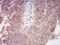 Mouse Monoclonal Antibody to AKT1