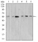 Mouse Monoclonal Antibody to AKT1