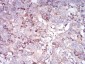 Mouse Monoclonal Antibody to CDH11