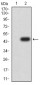 Mouse Monoclonal Antibody to CDH11