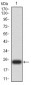 Mouse Monoclonal Antibody to UCP3