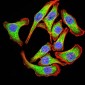 Mouse Monoclonal Antibody to PYCARD
