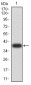 Mouse Monoclonal Antibody to PYCARD