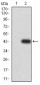 Mouse Monoclonal Antibody to PYCARD