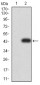 Mouse Monoclonal Antibody to SYN1