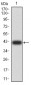 Mouse Monoclonal Antibody to SYN1