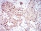 Mouse Monoclonal Antibody to Rab6b