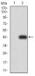 Mouse Monoclonal Antibody to Rab6b