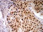 Mouse Monoclonal Antibody to LGALS1