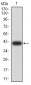 Mouse Monoclonal Antibody to LGALS1