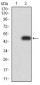 Mouse Monoclonal Antibody to LGALS1