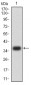 Mouse Monoclonal Antibody to PLD2