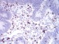 Mouse Monoclonal Antibody to CD2