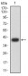 Mouse Monoclonal Antibody to CD2