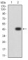 Mouse Monoclonal Antibody to CD2