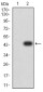 Mouse Monoclonal Antibody to CD274