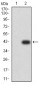 Mouse Monoclonal Antibody to SMAD1