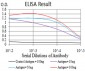 Mouse Monoclonal Antibody to TTF1