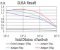 Mouse Monoclonal Antibody to TTF1