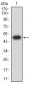 Mouse Monoclonal Antibody to CTNNA1