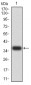 Mouse Monoclonal Antibody to PSMC3