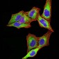Mouse Monoclonal Antibody to PSMC3