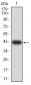 Mouse Monoclonal Antibody to POMC