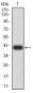 Mouse Monoclonal Antibody to SUZ12