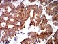 Mouse Monoclonal Antibody to PTPN14
