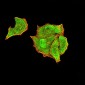 Mouse Monoclonal Antibody to PTPN14
