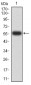 Mouse Monoclonal Antibody to PTPN14