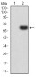 Mouse Monoclonal Antibody to PTPN14