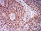 Mouse Monoclonal Antibody to BIN1