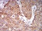 Mouse Monoclonal Antibody to EIF5