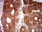 Mouse Monoclonal Antibody to EIF5