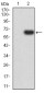 Mouse Monoclonal Antibody to EIF5