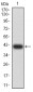 Mouse Monoclonal Antibody to C3C