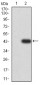 Mouse Monoclonal Antibody to CD2